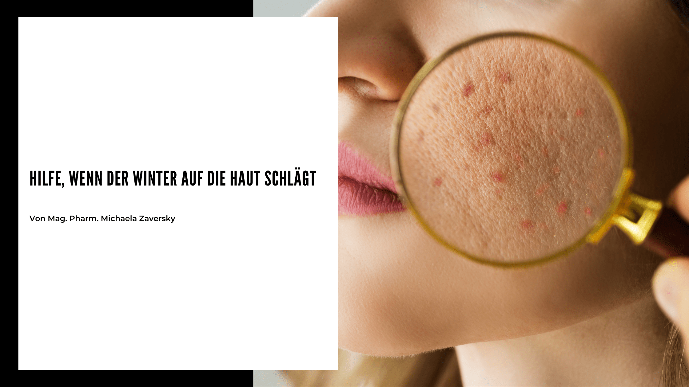 Hilfe, wenn der Winter auf die Haut schlägt - Apotheke Zaversky